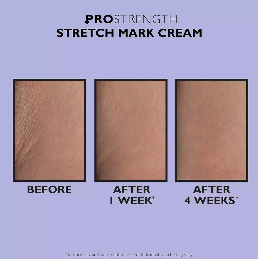 Peter Thomas Roth PRO Strength Stretch Mark Cream - 3.4fl oz